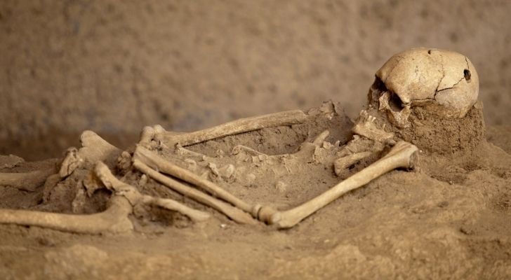 A human skeleton with a hole drilled in the skull