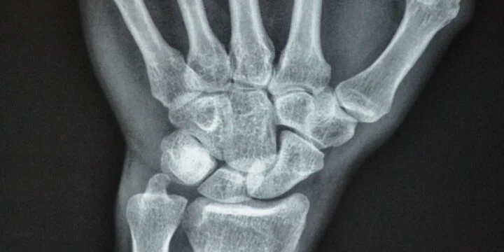 OTD in 1895: German physicist Wilhelm Conrad Röntgen discovered x-rays.