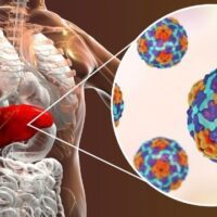 July 28: World Hepatitis Day