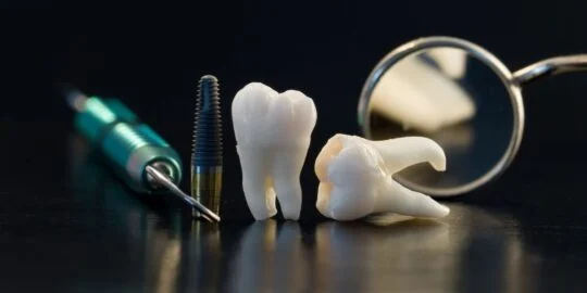 Why Do We Have Wisdom Teeth?
