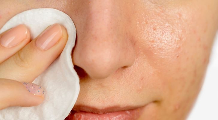 A woman brushes makeup off of her face with a makeup removal cloth